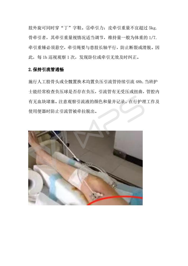 股骨颈03.jpg