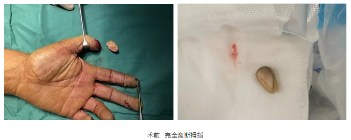 微信截图_20181113143358.png